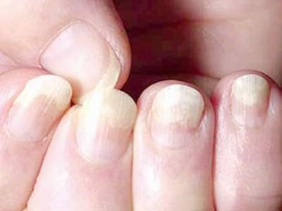 Các bệnh về tay và cách bảo vệ tay khi làm việc